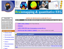 Tablet Screenshot of brainmapping.yassermetwally.com